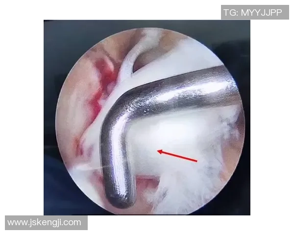 足球明星因交叉韧带断裂重返赛场的艰辛历程与复苏之路